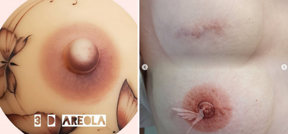 Areola Pictures